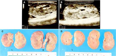 Case report: BCL-2 and CD31 immunoexpression related to clinical and histopathological evaluation of renal dysplasia in a Welsh Corgi Puppy